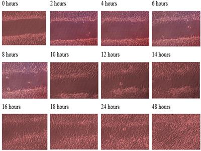 Effect of TGF-β3 on wound healing of bone cell monolayer in static and hydrodynamic shear stress conditions
